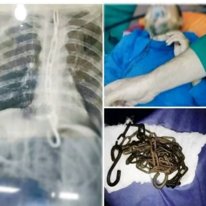 J0ven fue h0spital1zada tras ser pen…Ver más